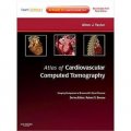 Atlas of Cardiovascular Computed Tomography: Expert Consult - Online and Print