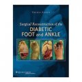 Surgical Reconstruction of the Diabetic Foot and Ankle [精裝]