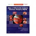 Atlas of Minimally Invasive Thoracic Surgery (VATS) [精裝] (微創胸外科圖譜 (附網絡版))