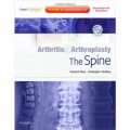 Arthritis and Arthroplasty: The Spine [精裝] (關節炎與關節形成術:脊柱(配盤))