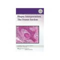 Biopsy Interpretation: The Frozen Section (Biopsy Interpretation Series) [精裝]
