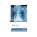 Pocket Guide to Chest X-rays [Vinyl Bound] [平裝]