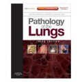 Pathology of the Lungs [精裝] (肺病理學)