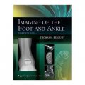Imaging of the Foot and Ankle [精裝]