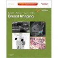 Breast Imaging [平裝] (乳腺影像:病例點評系列)