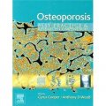 Osteoporosis [平裝] (骨質疏鬆症:最佳實踐與研究概要)
