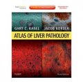Atlas of Liver Pathology [精裝] (肝臟病理圖譜 第3版 (附網絡版))