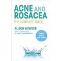 Acne and Rosacea: The Complete Guide [平裝]