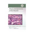 Biopsy Interpretation of the Thyroid (Biopsy Interpretation Series) [精裝]