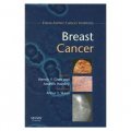 Early Diagnosis and Treatment of Cancer Series: Breast Cancer [精裝] (癌症的早期診斷系列:乳腺癌)