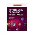 Cryoablation of Cardiac Arrhythmias [精裝] (心律失常冷凍消融術)
