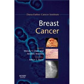 Breast Cancer [平裝] (乳腺癌:Dana-Farber癌症研究學會手冊)