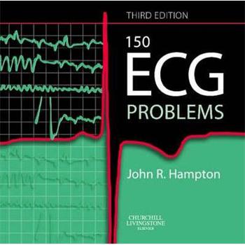 150 ECG Problems [平裝] (150個心電圖問題)