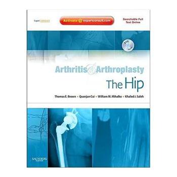 Arthritis and Arthroplasty: The Hip [精裝] (髖關節炎與關節成形術:專家顧問－在線版與印刷版)