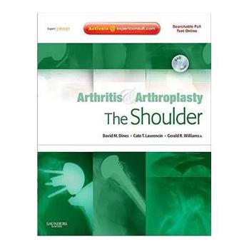 Arthritis and Arthroplasty: The Shoulder [精裝] (肩關節炎與關節成形術:專家顧問－在線版與印刷版)