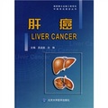 國家重大出版工程項目中國常見癌症叢書：肝癌